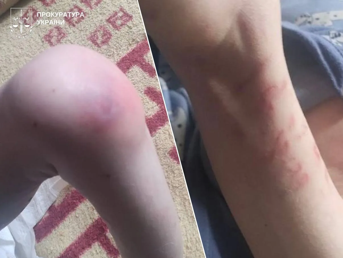 Таргани, недоїдання та синці: під Києвом троє дітей жили без належного догляду, прокуратура відкрила провадження